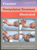  Fracture Manipulation Treatment Illustrated (Yuan Fang; Li Zhaoguo)