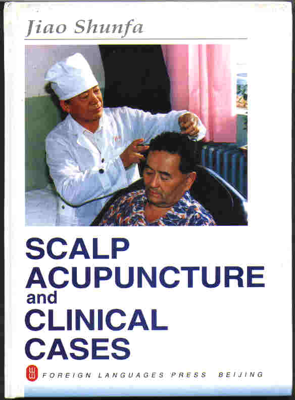  Scalp Acupuncture and Clinical Cases (Jiao Shunfa)